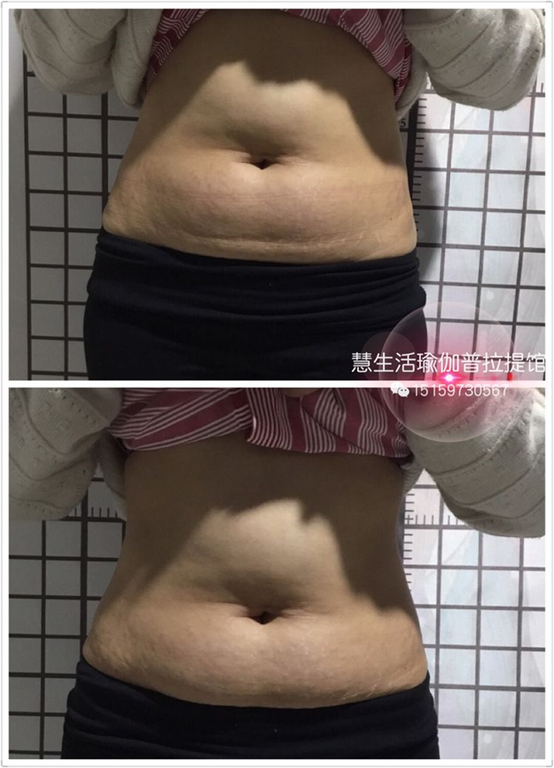 慧·生活瑜伽重磅福利！快来报名中国好声音全国海选泉州赛区！——九房网